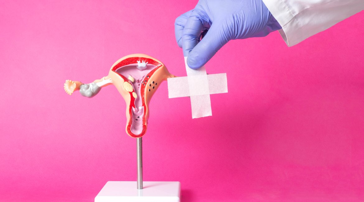 A doctor's hand holding up a bandage to a model uterus